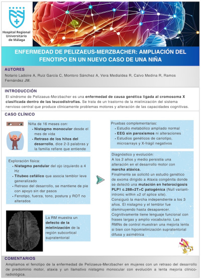 P.06. Enfermedad de Pelizaeus-Merzbacher: ampliación del fenotipo en un nuevo caso de una niña