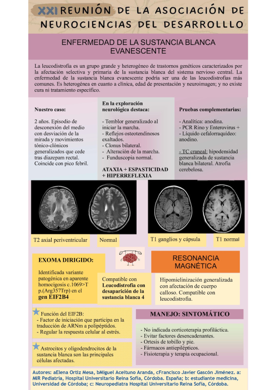 P.11. Enfermedad de la sustancia blanca evanescente